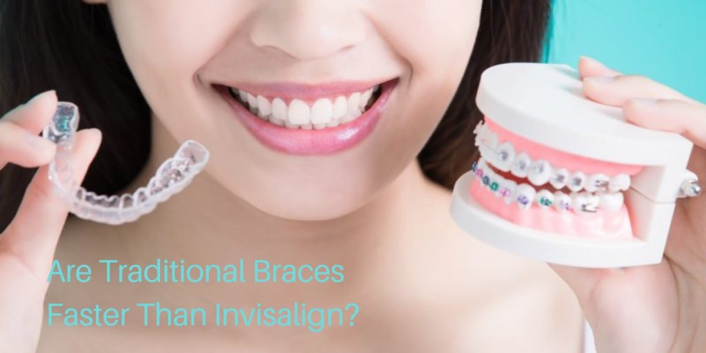 Are Traditional Braces Faster Than Invisalign?
